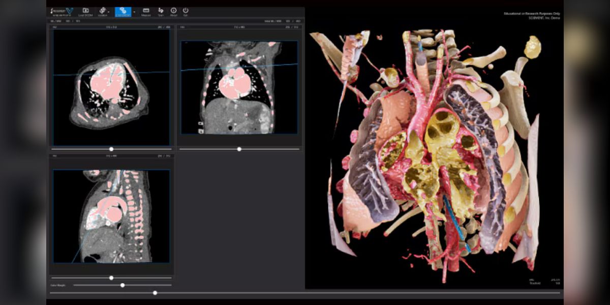 SCIEMENT tackles congenital heart defects with Sony’s Spatial Reality Display